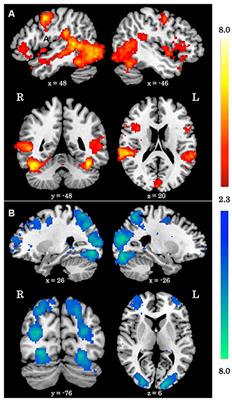 Neural Response to Biological Motion in Healthy Adults Varies as a Function of Autistic-Like Traits